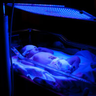 newborn jaundice aap guidelines