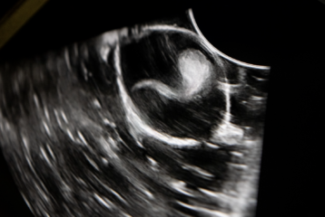 zebra shark pup hatched in Indonesia ultrasound